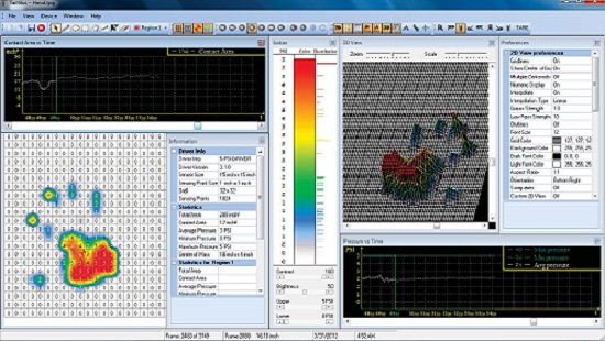 壓力分布儀器足弓檢測的應用